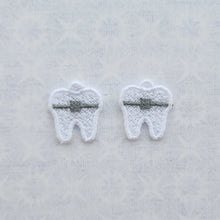 Load image into Gallery viewer, Braces